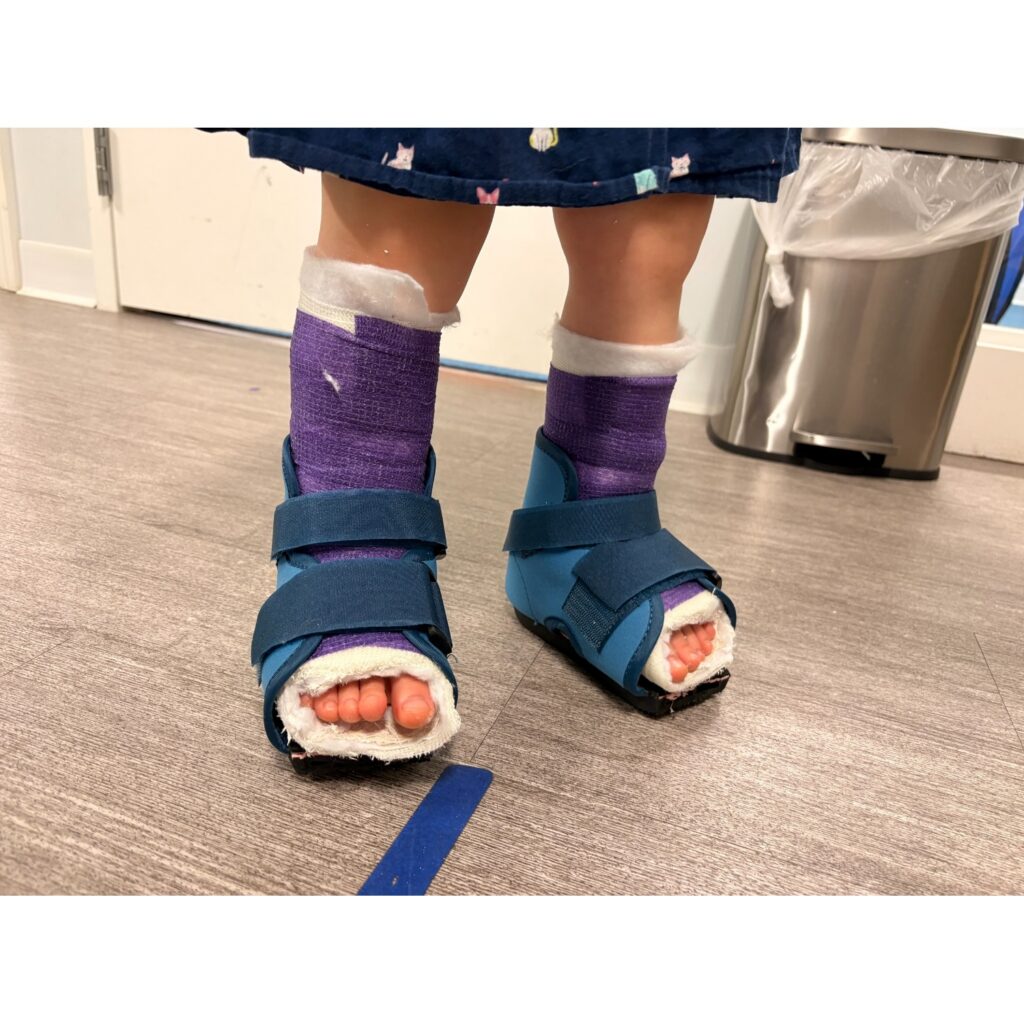 little feet in cast